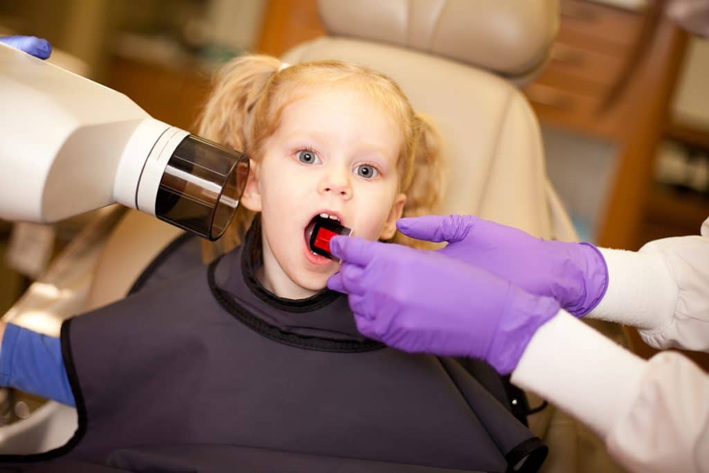 Preventing Cavities in Your Child's Mouth