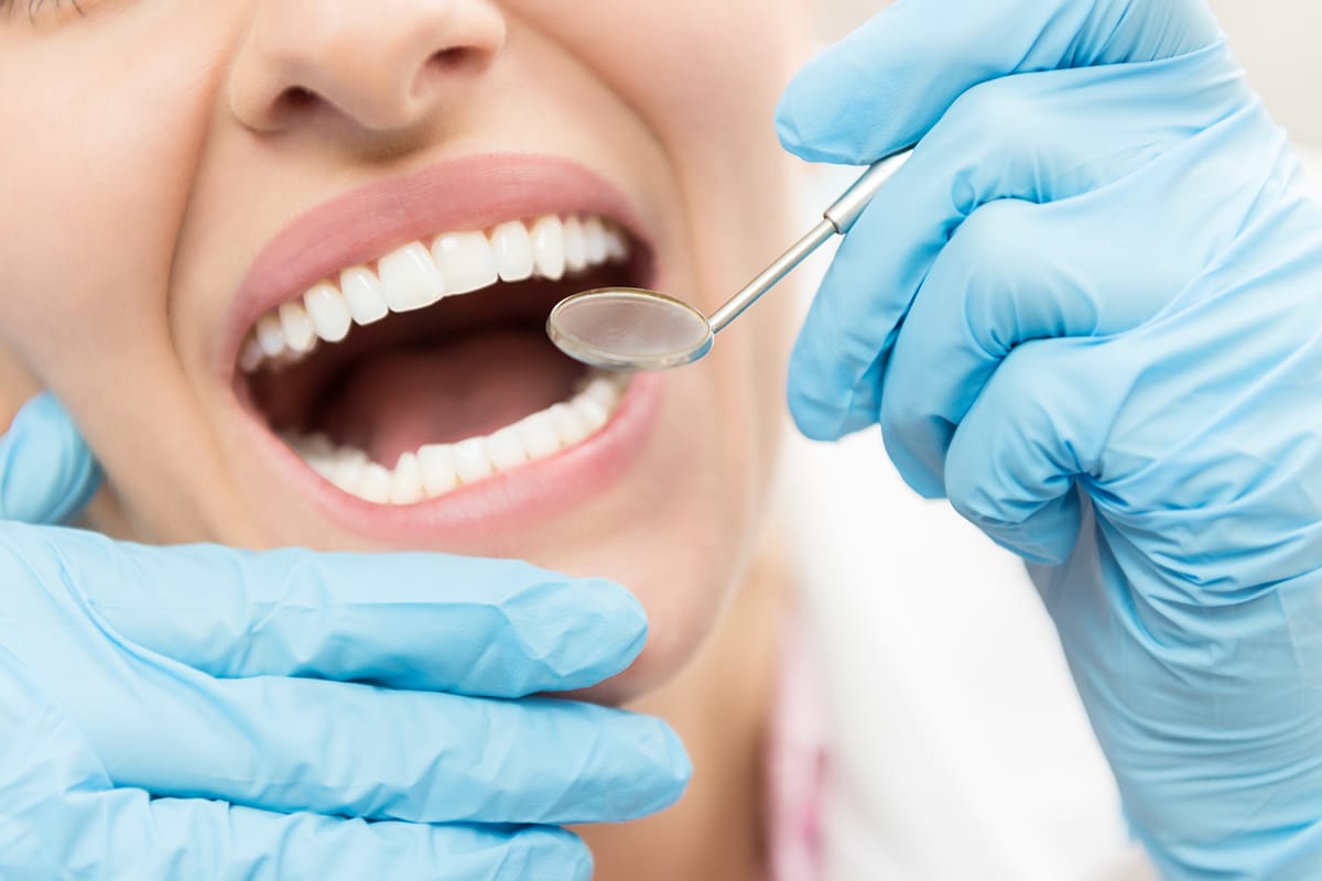 How Long Does a Cavity Filling Take Memphis PDOC