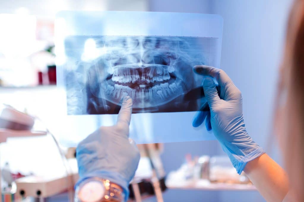 How Often Should Kids Get Dental X-Rays?